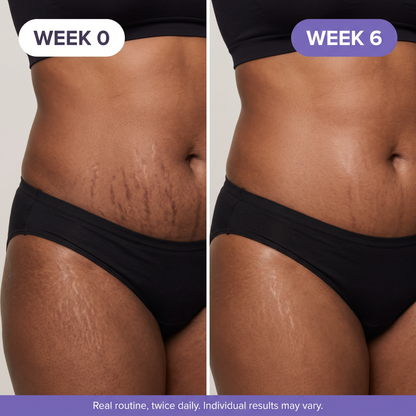 Hey Tummy! Tighten & Smooth Belly Cream