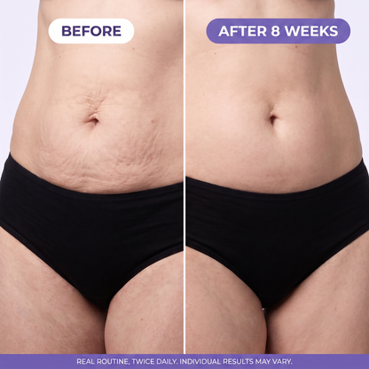 Hey Tummy! Tighten & Smooth Belly Cream